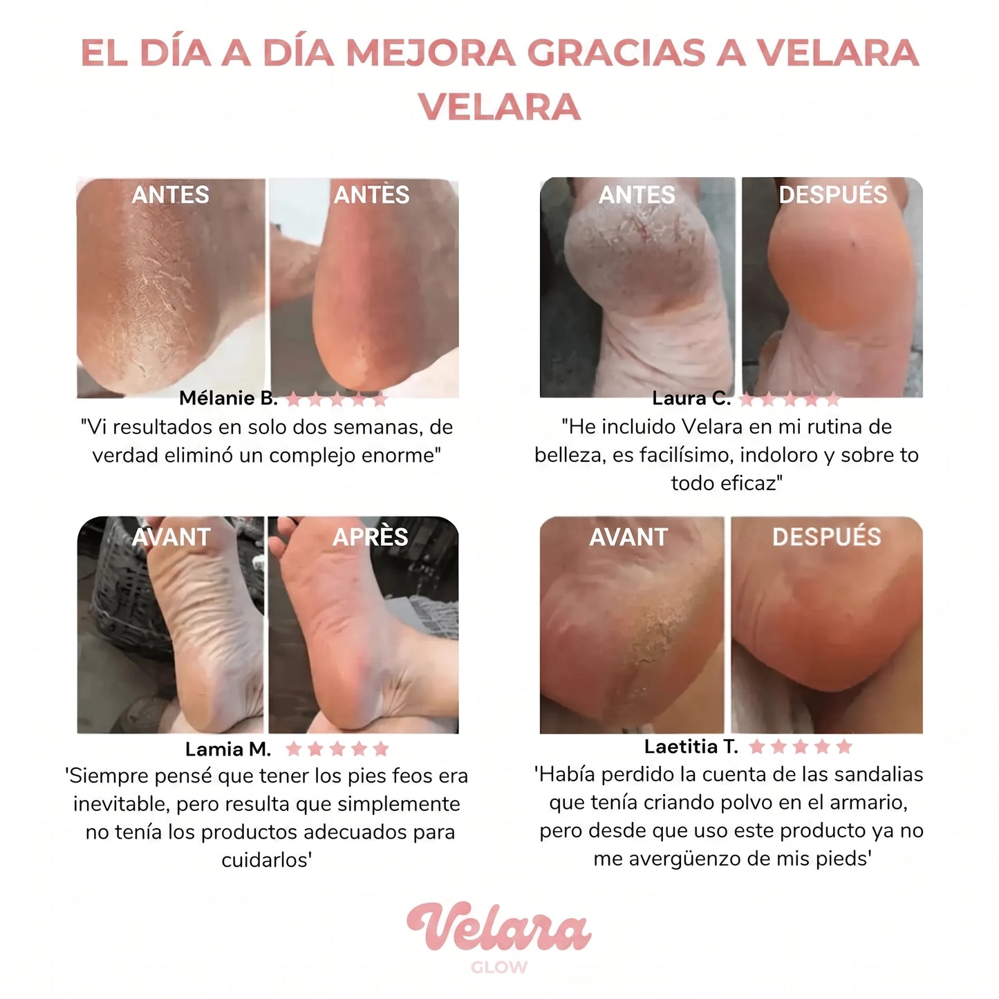 ✨ VelaraGlow™ – Kit de Cuidado para los Pies