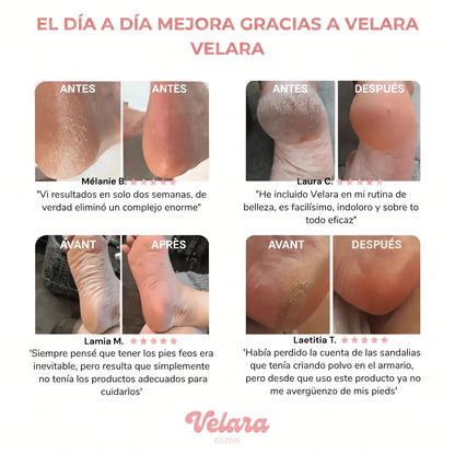 ✨ VelaraGlow™ – Kit de Cuidado para los Pies