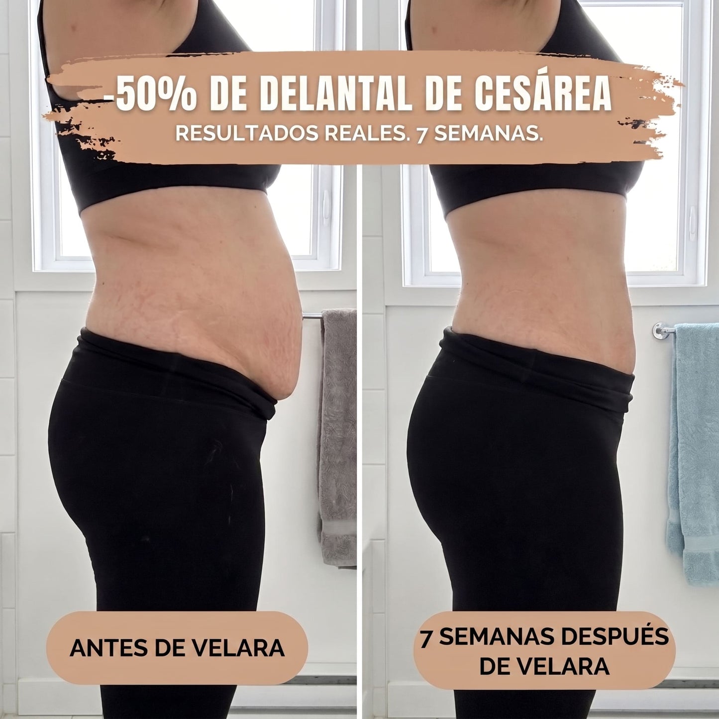 Velara™ – Braga Faja Moldeadora 360° con Efecto Push-Up