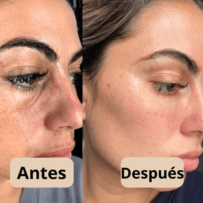 Peel Shot - Elimina las Impurezas y Realza la Belleza de tu Piel