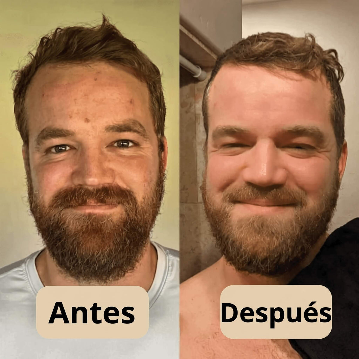 Peel Shot - Elimina las Impurezas y Realza la Belleza de tu Piel