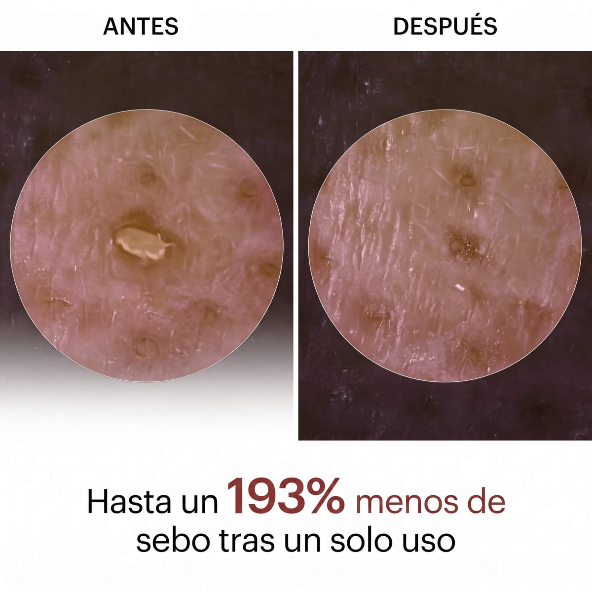 Peel Shot - Elimina las Impurezas y Realza la Belleza de tu Piel