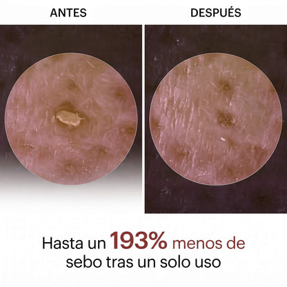 Peel Shot - Elimina las Impurezas y Realza la Belleza de tu Piel